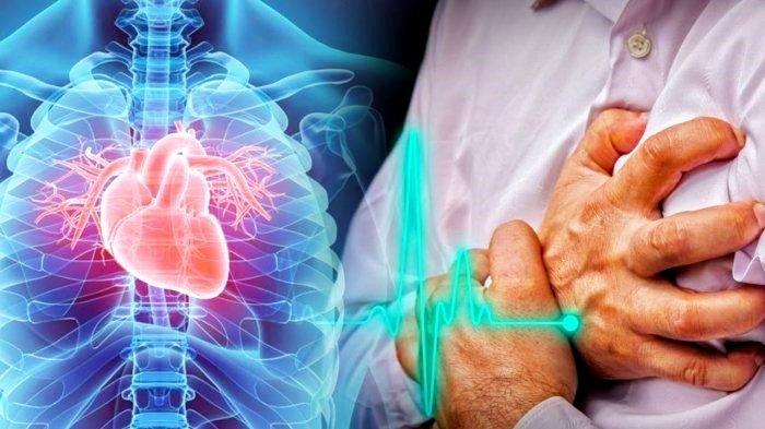 Bukan Hanya Nyeri Dada! 7 Gejala Serangan Jantung pada Perempuan yang Sering Diabaikan